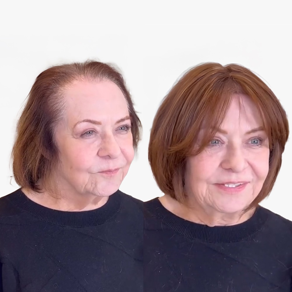 Premium Lace Hair Topper for Thinning Crown Auburn Brown Before & After